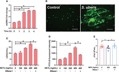 Taurine inhibits Streptococcus uberis-induced NADPH oxidase-dependent neutrophil extracellular traps via TAK1/MAPK signaling pathways